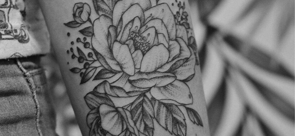 Fjernelse af tatovering